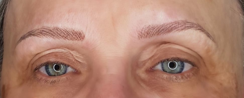 Creation ligne sourcilière complète. Cliente qui n’avait plus aucun poil suite à un traitement médicamenteux. Technique maquillage permanent « poil à poil « . Résultat hyper-réaliste.