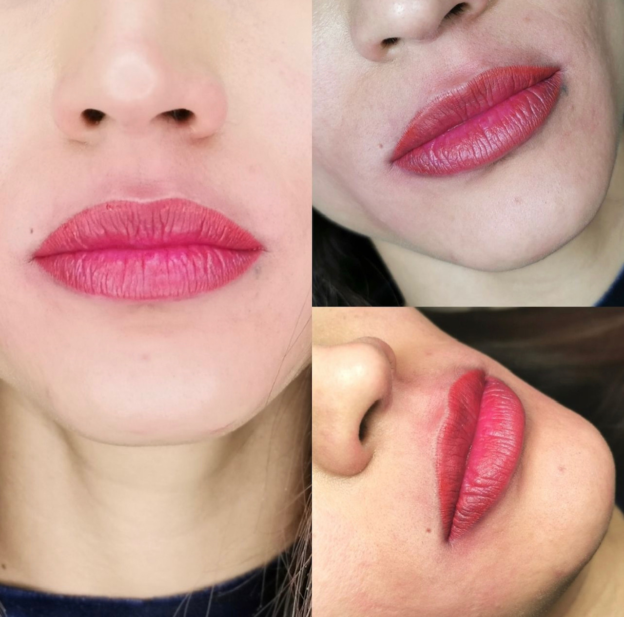 Maquillage permanent bouche "Candy lips". Cliente de Villefranche. 